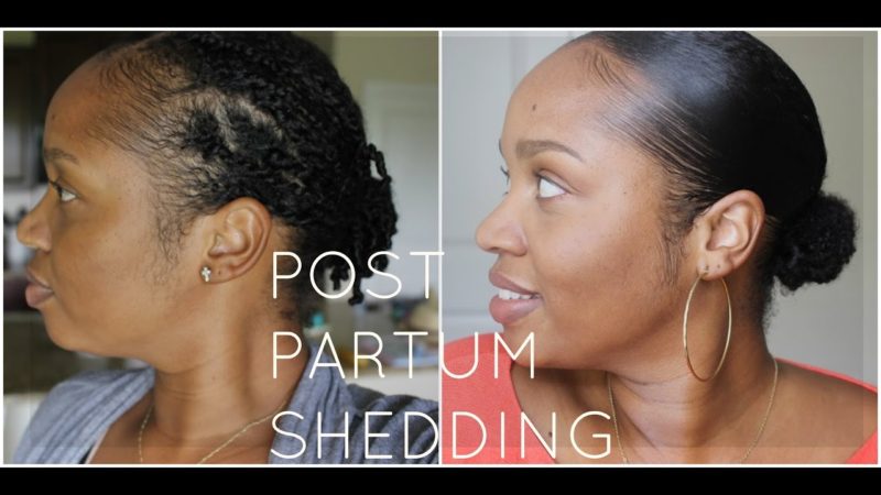 I survived: Postpartum Shedding on Natural Hair